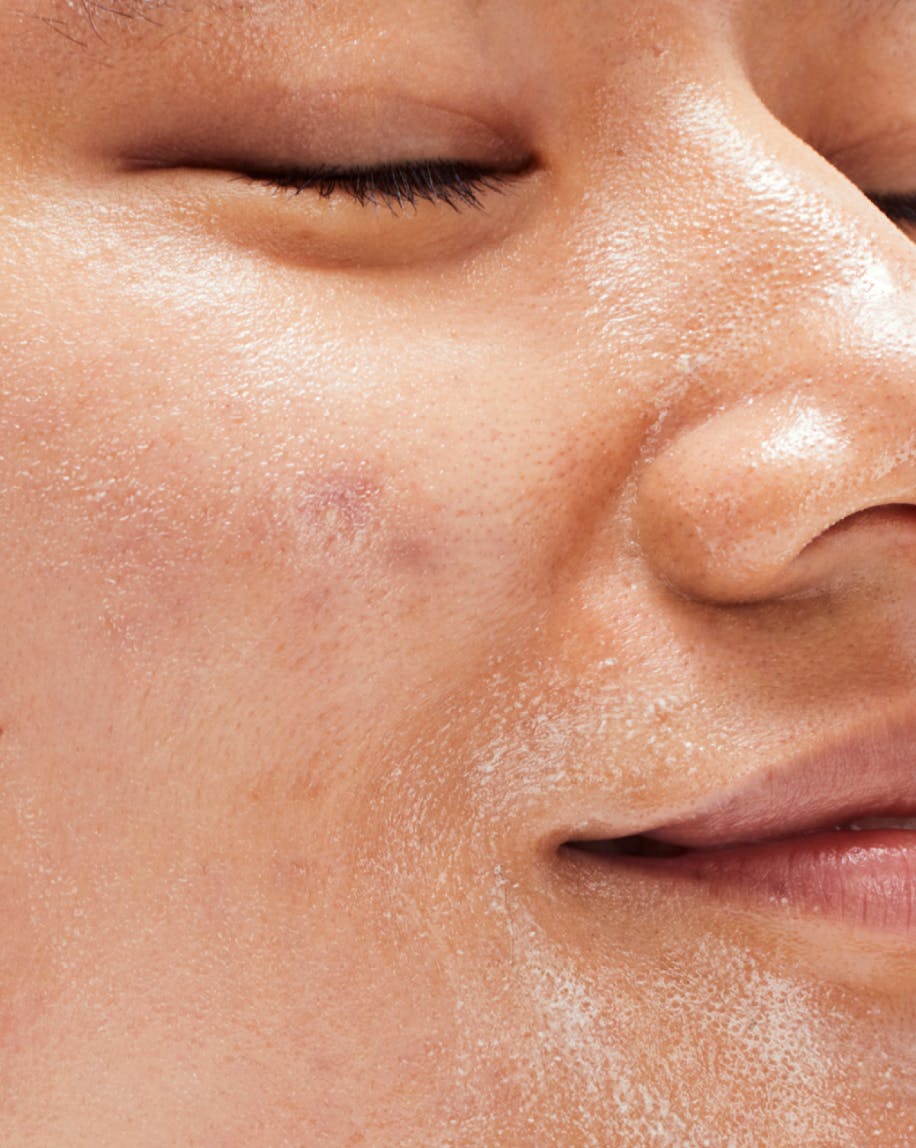 skin texture up close